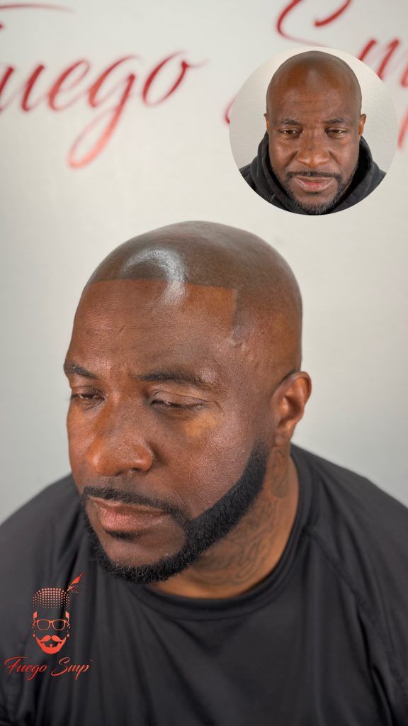 Client with finished SMP and beard, before shown inset