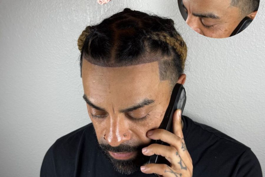 Client with completed SMP hairline, before shown inset